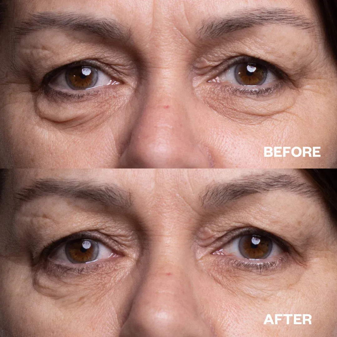 3-Step Eye Renewal Pack