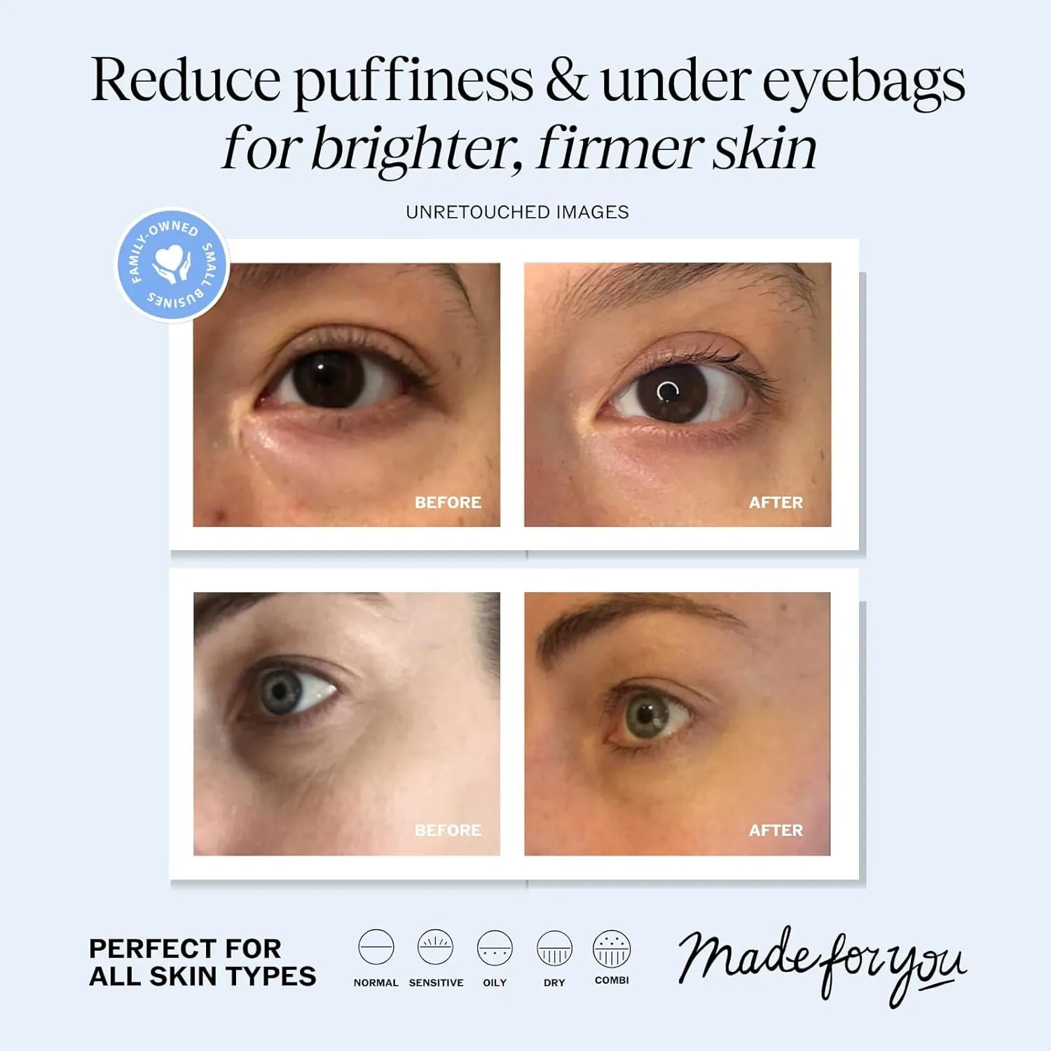 Eye Cream for Dark Circles and Puffiness, under Eye Cream for Wrinkles and Bags, anti Aging Eye Cream Helps Improve Dryness; for Sensitive Skin - 1.7 Oz - Made in USA